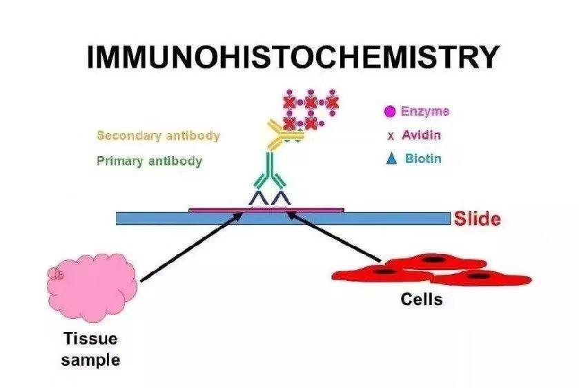 一图看懂免疫组化_免疫组化图像怎么看_如何看懂免疫组化图解
